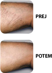 modre razvejane žilice